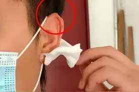 小伙去理发，担心的事情发生了……医院：已造成不可逆损伤图片