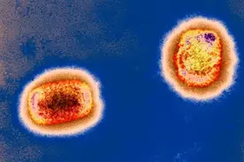 多国出现猴痘病例，会成为另一个大规模传染病吗图片