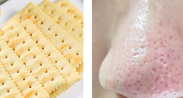 阿达帕林去黑头