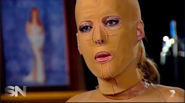 一瘦遮百丑,尤其是脸,可你知道你胖的原因是什么吗?