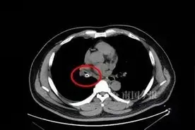 南国法援丨物管未经业主同意，强行安装变压器，怎么办？图片