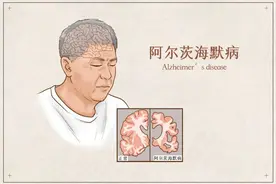 老年人记忆力不好就是痴呆？6个关于老年痴呆的常见问题图片