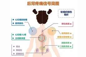 后背疼与多种病有关！一张图看得明明白白图片