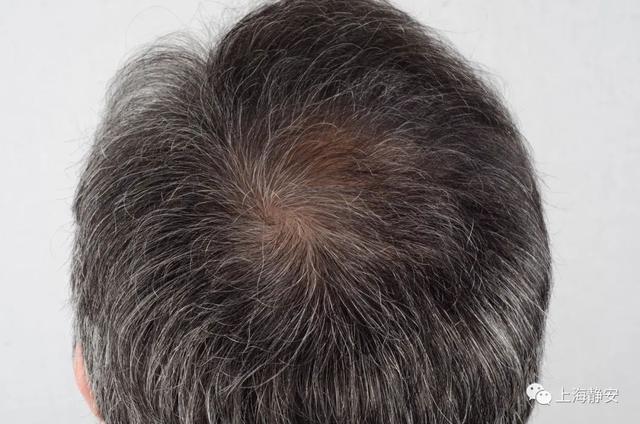 骞寸邯杞昏交灏辩櫧鍙戯紵娉ㄦ剰锛佽繖浜涘潖涔犳儻姝ｅ湪鍔犻€熺櫧鍙戠殑鐢熸垚鈥︹€? onerror=