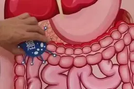 夫妻双双患癌，这些或是“元凶”！提醒：4种“夫妻癌”尤为高发，预防其实并不难图片