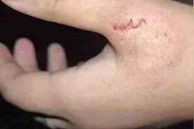 哈啰顺风车副驾抢司机方向盘，后排乘客劝阻被咬伤！客服回应图片