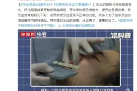 牙齿是越白越好吗？淡黄色的牙齿才更健康图片