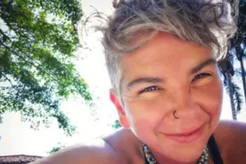 英国女子自称多次被外星人绑架，睡醒后身上布满“奇怪”淤青图片