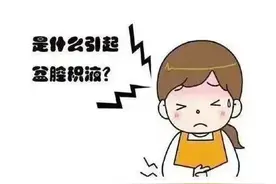 【妇产科普】B超单上写的“盆腔积液”是什么？图片