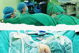 妇科手术无疤无痛 淄博市中心医院经阴道单孔腹腔镜精准摘掉子宫肿物图片