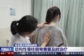 孩子居家学习总坐没坐相挺不直腰？网购矫正器小心适得其反图片
