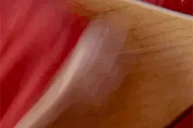 想帮林允开一开笑脸特效图片