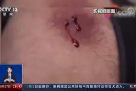 模仿影视剧用嘴吸毒，南安一女子满口流血……图片