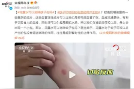 花露水可以消除蚊子包吗？听听医生怎么说图片