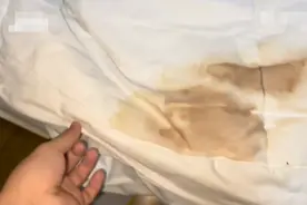 连锁酒店被子现大片血渍，男子裸睡一晚后才发现，直呼恶心图片