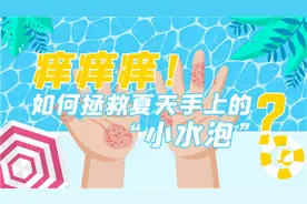 痒痒痒！如何拯救夏季手上的“小水泡”？图片