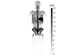 人类首次！新冠患者全身T细胞无创可视化图片