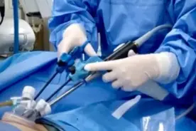 厦门16岁少女肚子痛，一查竟是恶性肿瘤！妇科最“狠”的癌症，常查出就是晚期图片