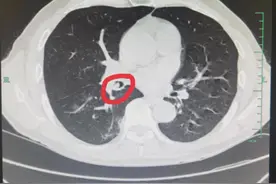 热昏头！杭州男子喝冰啤酒大嚼花生米，差点乐极生悲图片