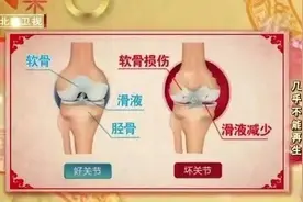 ​为什么掰手指会“咔咔”响？会不会得关节炎？看完再也不敢了……图片