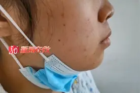 依兰一女子最近总流鼻血，可能是她儿时埋下的“祸根”……图片