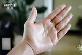 夏季手脚多汗是咋回事？又该如何缓解？专家有妙招图片