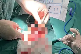 9岁男童骑车摔倒，“蛋蛋”险些摔出“保护膜”图片