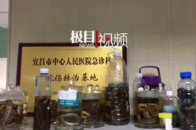 盛夏时节人蛇易狭路相逢，这家医院恰好有位“蛇伤圣手”图片