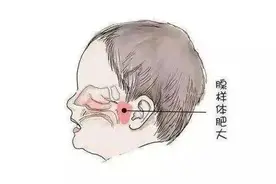 儿童鼾症的危害.....图片