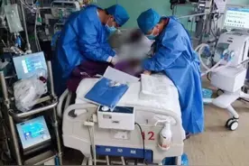国产首套急救转运型ECMO应用于临床 成功救治一名濒死患者图片