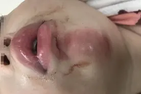 “遛娃神器”出事故！婴儿车推行中突然折叠致女童摔伤图片