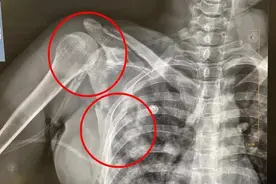 “医生，救救我，我还有3个孩子”生命垂危的母亲用最后的清醒说图片