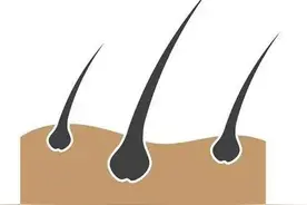 脱一次毛至少白一度？是真的吗？图片