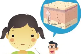 夏季皮肤奇痒难耐？可能是这种皮炎在发威图片