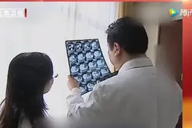 不起眼的痣，竟可能暗藏“癌变风险”？长在这里尤其危险！快看你身上有没有图片