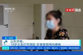 打耳洞致颅内感染上热搜！关于打耳洞，我们专门请教了医生图片