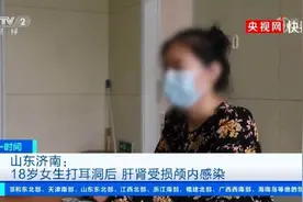 打耳洞致颅内感染上热搜！关于打耳洞，我们专门请教了医生图片