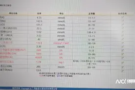 动感单车+两天筋膜枪按摩，健身小姐姐三处横纹肌溶解图片