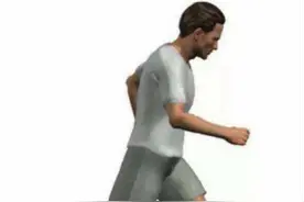 膝关节内侧痛找不到原因？小心这个病！图片