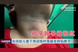 自闭症儿童上课遭老师掐脖子，涉事老师道歉图片