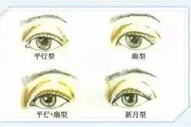 济南海峡整形分享：双眼皮这样做才好看图片