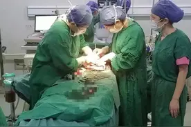 孕妇突发脐带脱垂！医生弯腰托举胎儿32分钟赢得生机图片