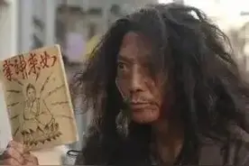 膝盖扭伤？错，是髌骨脱位！这病女多男少，手术要乘早图片