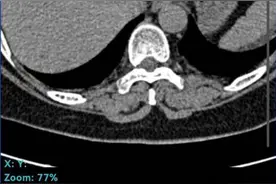山东这家医院上线“云胶片”服务，影像报告扫码可见图片