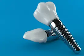 一口种植牙一辆特斯拉！医保局要给市场“降温”，种植牙要降价了？图片