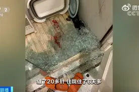 可怕！男子洗澡时淋浴房玻璃门突然爆裂：缝了20多针图片