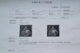 52岁男子被头痛困扰十年，劳累时症状明显，竟然是先心病图片