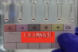 江苏罕见“黄金血型”引热议，医生：输血条件严苛，需提前干预图片