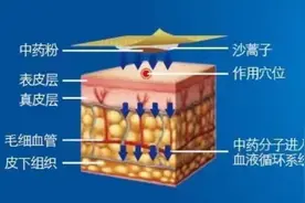 小小贴敷，大大作用图片