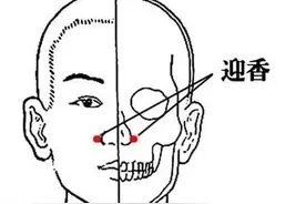 亲测管用，这样做能让过敏性鼻炎没那么难受图片